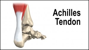 achilles-tendon3